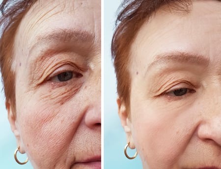 Anti Aging Face Stock Photos And Images - 123RF